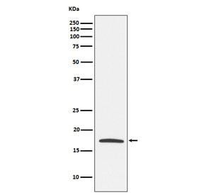 Anti-Claudin 4 / CLDN4, clone ADEB-3
