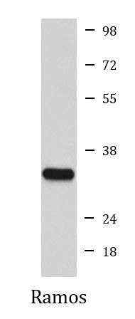 Anti-CD74