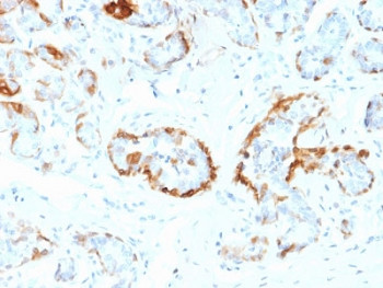 Anti-Alpha B Crystallin / CRYAB, clone CPTC-CRYAB-1