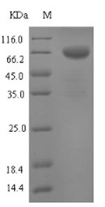 Tryptophan 5-hydroxylase 1 (Tph1), mouse, recombinant