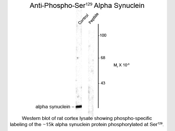 Anti-phospho-alpha Synuclein (Ser129)