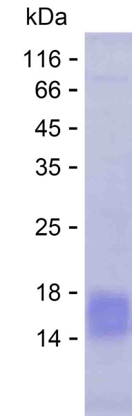 ITGB2 (human), recombinant protein