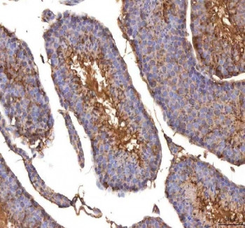 Anti-ISYNA1 / Inositol-3-phosphate synthase 1 / INO1
