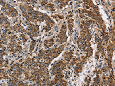 Anti-KCNQ4