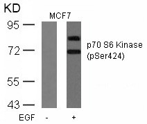 Anti-phospho-p70 S6 Kinase (Ser424)