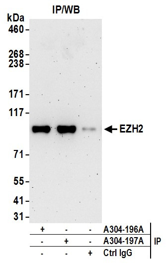 Anti-EZH2