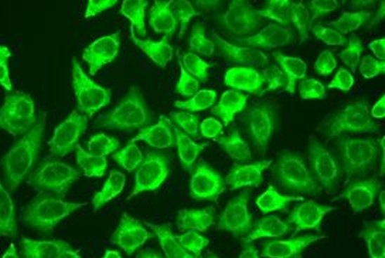 Anti-GIF / Gastric intrinsic factor