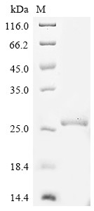 Prolactin (Prl), rat, recombinant