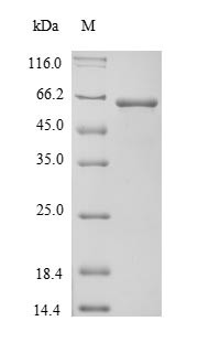 Alpha-fetoprotein (Afp), mouse, recombinant