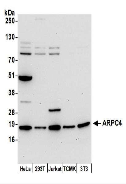 Anti-ARPC4