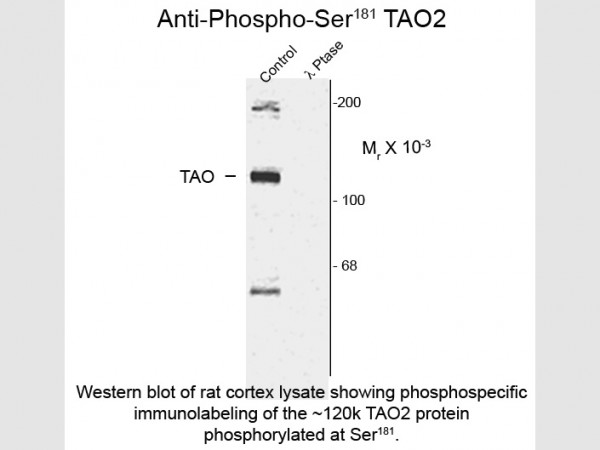 Anti-phospho-TAO2 (Ser181)