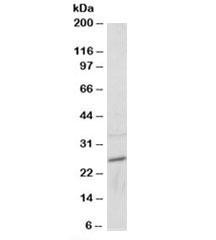 Anti-RAB11A