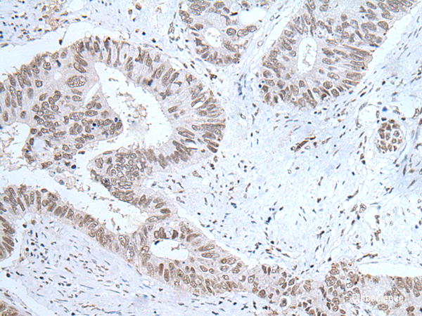 Anti-HCRT
