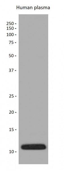 Anti-Apolipoprotein CIII