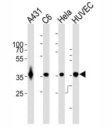 Anti-GAPDH, clone 1A10A10