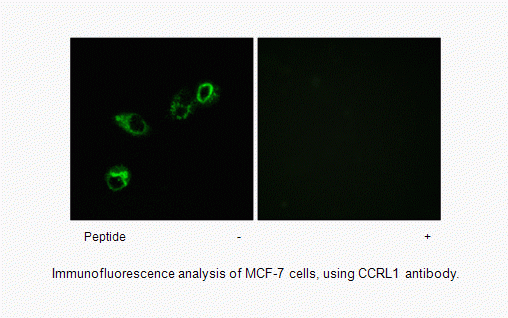 Anti-CCRL1