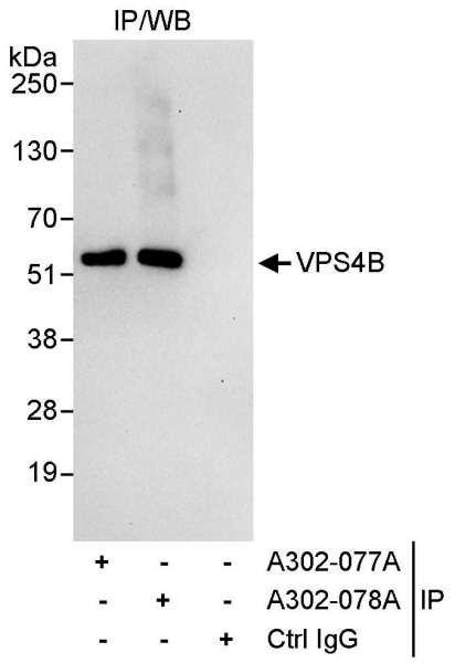 Anti-VPS4B