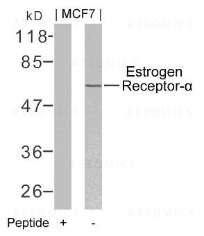 Anti-Estrogen Receptor- Alpha (Ab-106)