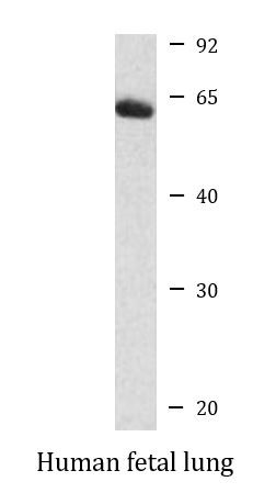 Anti-MCOLN1 / TRPML1