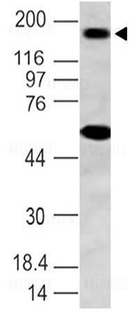 Anti-NALP3 (Clone: ABM2D48)