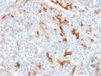 Anti-NGF-Receptor (p75) / CD271 (Soft Tissue Tumor Marker) Recombinant Rabbit Monoclonal Antibody (c