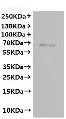 Transient receptor potential cation channel subfamily V member 6 (Trpv6)-VLPs, recombinant mouse