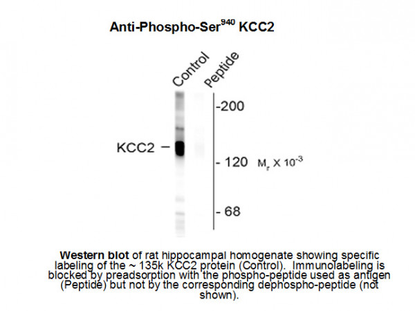 Anti-phospho-Potassium Chloride Cotransporter (KCC2) (Ser940)
