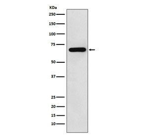 Anti-N-WASP / Neural Wiskott-Aldrich syndrome protein, clone ACOB-23