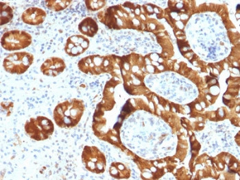 Anti-SULT1E1 / Estrogen Sulfotransferase, clone CPTC-SULT1E1-1