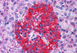 Anti-Annexin A10 / Annexin 14, N-terminal