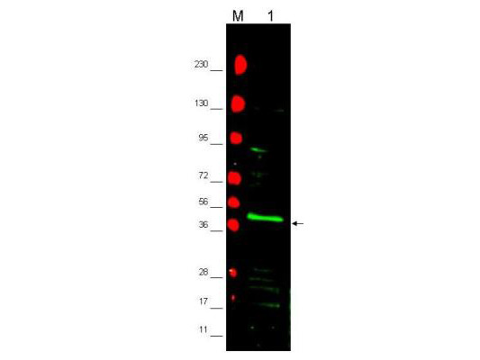 Anti-PPARg2, NT (Peroxisome Proliferator Activated Receptor, gamma)