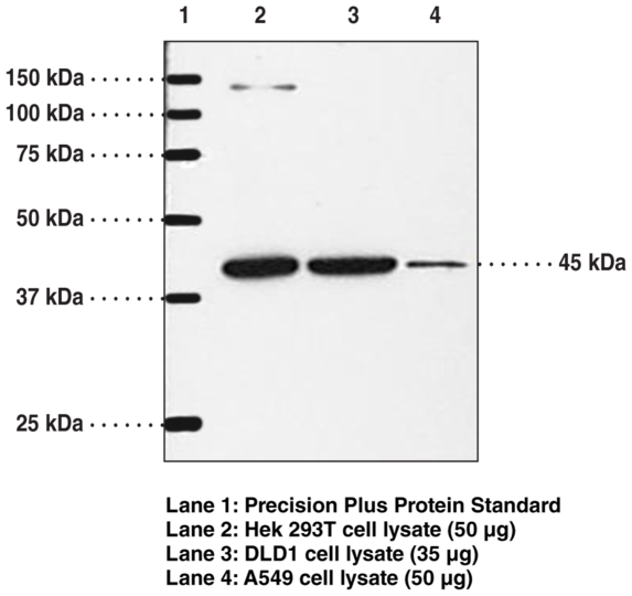Anti-IP Receptor (mouse)