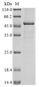 Prolactin regulatory element-binding protein (PREB), partial, human, recombinant