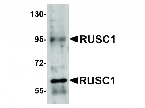 Anti-RUSC1