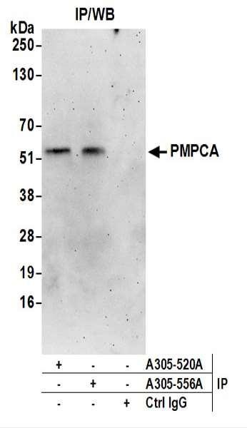 Anti-PMPCA