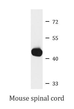 Anti-UQCRC2