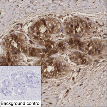 Anti-PDCD4