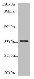 Anti-SLC35B1