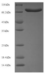 Acyl-CoA-binding domain-containing protein 5 (ACBD5), partial, human, recombinant