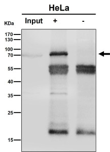 Anti-PREPL / Prolyl endopeptidase-like protein, clone 30P78