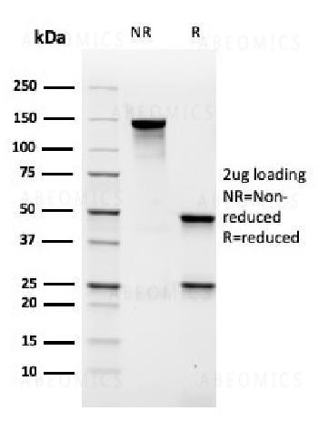 Anti-MALT1 (MALT-Lymphoma Marker) Monoclona Antibody (Clone: rMT1/410)