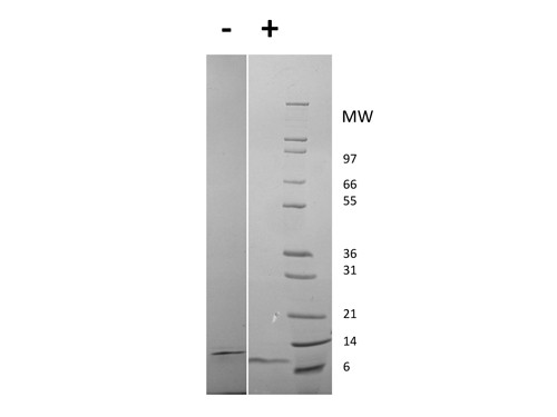 Epidermal Growth Factor