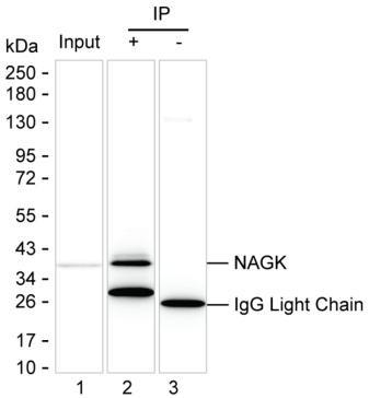 Anti-NAGK