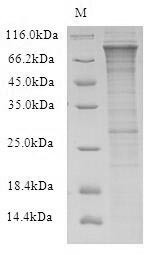 E3 ubiquitin-protein ligase RFWD2 (RFWD2), human, recombinant
