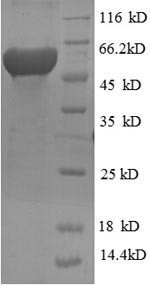 Ribonucleoside-diphosphate reductase subunit M2 (RRM2), human, recombinant
