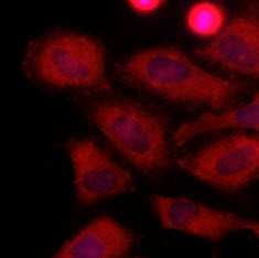 Anti-LDHA, clone 1A4
