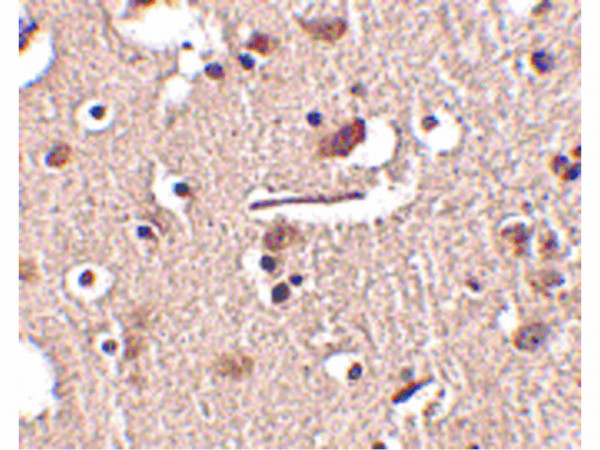 Anti-Slitrk2