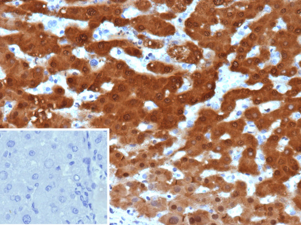 Anti-Arginase 1 (Hepatocellular Carcinoma Marker), clone ARG1/9448