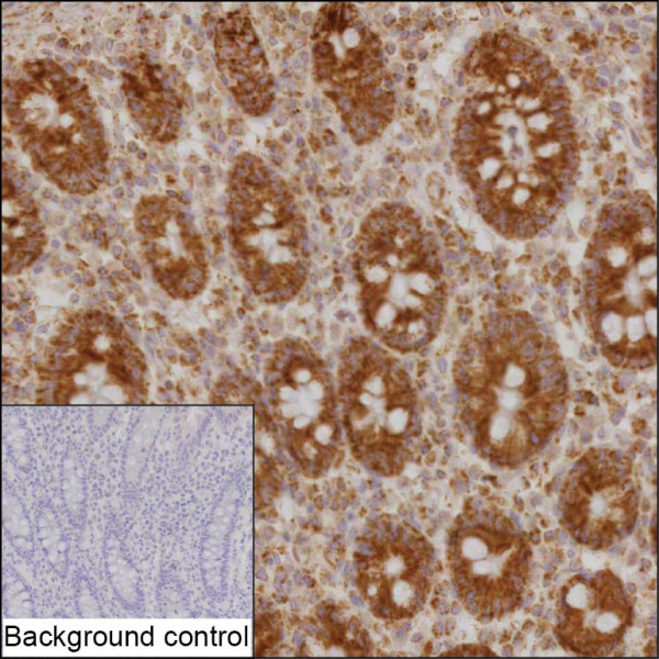 Anti-ACAD8