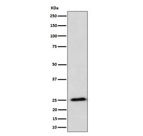 Anti-RPL10A / Large ribosomal subunit protein uL1, clone 29R56